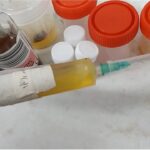 Synovial Fluid Culture and Sensitivity Test-Introduction, Report, Clinical Significance, Common Pathogens, and Keynotes