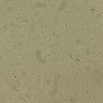 Aeromonas hydrophila-Introduction, Morphology, Pathogenicity, Lab Diagnosis, Treatment, Prevention, and Keynotes