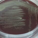 Gemella morbillorum -Introduction, Morphology, Pathogenicity, Lab Diagnosis, Treatment, Prevention, and Keynotes