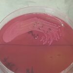 Raoultella ornithinolytica-Introduction, Morphology, Pathogenicity, Lab Diagnosis, Treatment, Prevention, and Keynotes