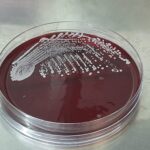 Staphylococcus hominis- Introduction, Morphology, Pathogenicity, Lab Diagnosis, Treatment, Prevention, and Keynotes