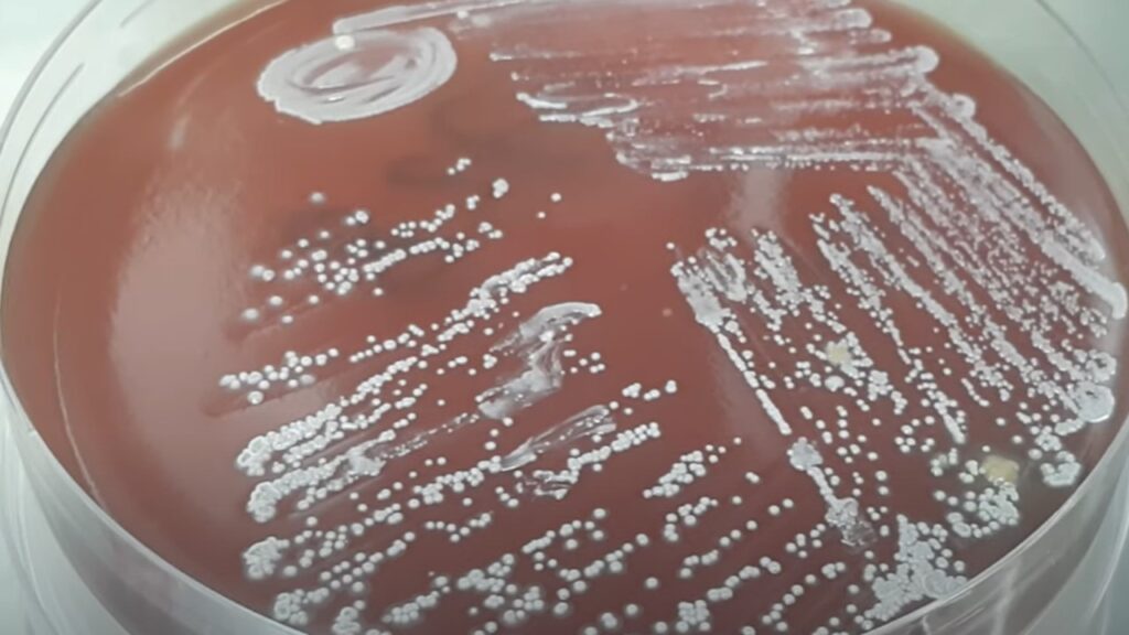 Nocardia – Introduction, Morphology, Pathogenicity, Lab Diagnosis, Treatment, Prevention, and Keynotes
