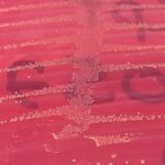 Staphylococcus sciuri- Introduction, Morphology, Pathogenicity, Lab Diagnosis, Treatment, Prevention, and Keynotes