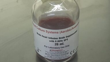 Bloodstream Infection(BSI) Introduction, List of common causative agents, and Keynotes