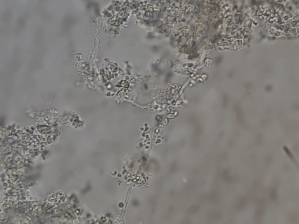 Fungal elements in KOH Mount of Urine Microscopy- Introduction, Fungal Elements Observed in Urine KOH Mount, Applications, and Keynotes