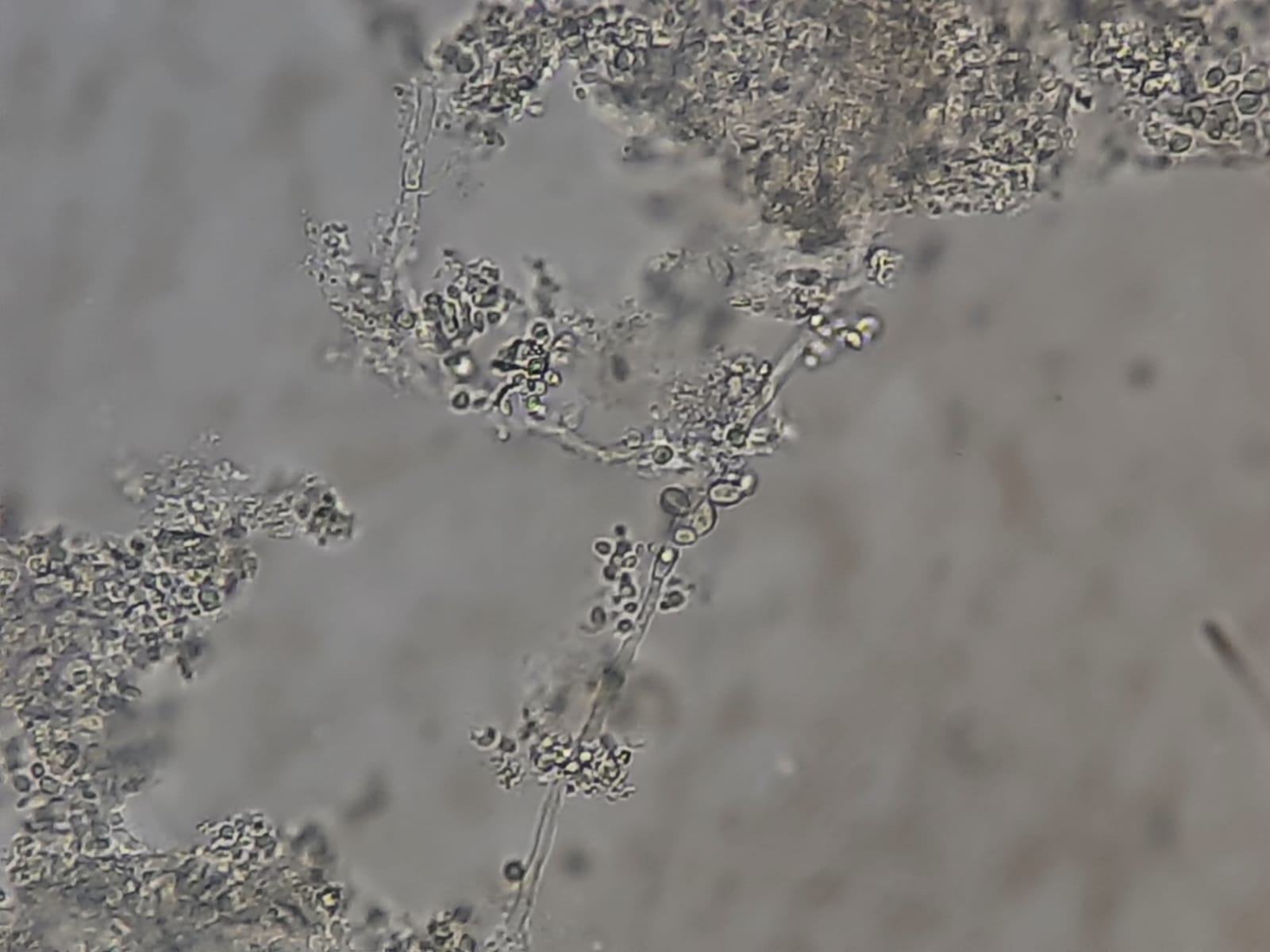 Fungal Elements in KOH Mount of Urine Microscopy- Introduction