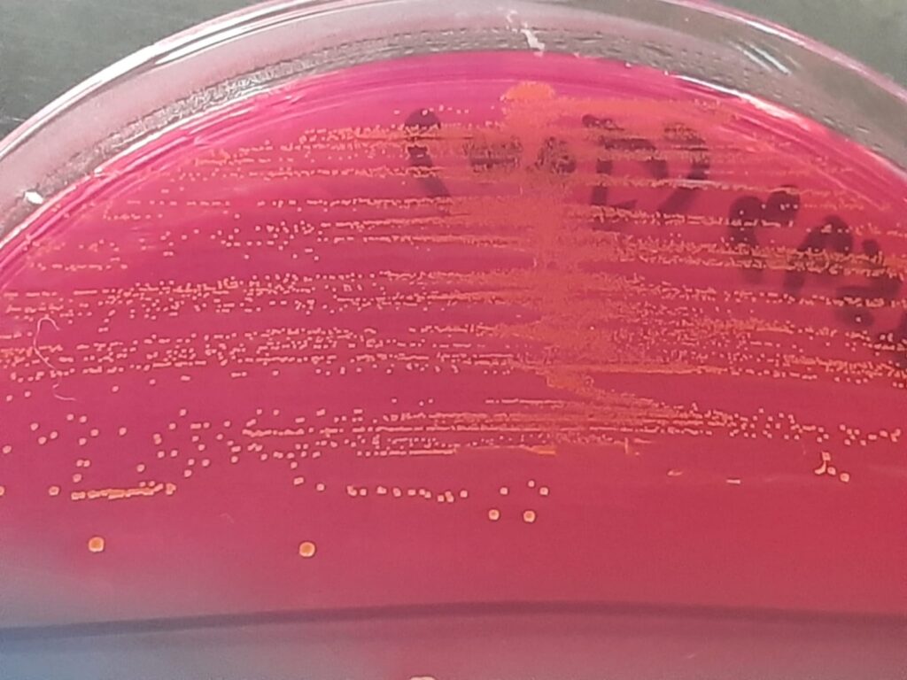 Lactococcus- Introduction, Pathogenicity, Lab Diagnosis, Treatment, Prevention, and Keynotes
