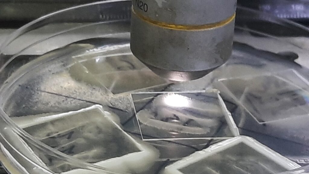 Dalmau plate culture- Introduction, Purpose and Mechanism, Procedure, and Key Morphological Identifiers