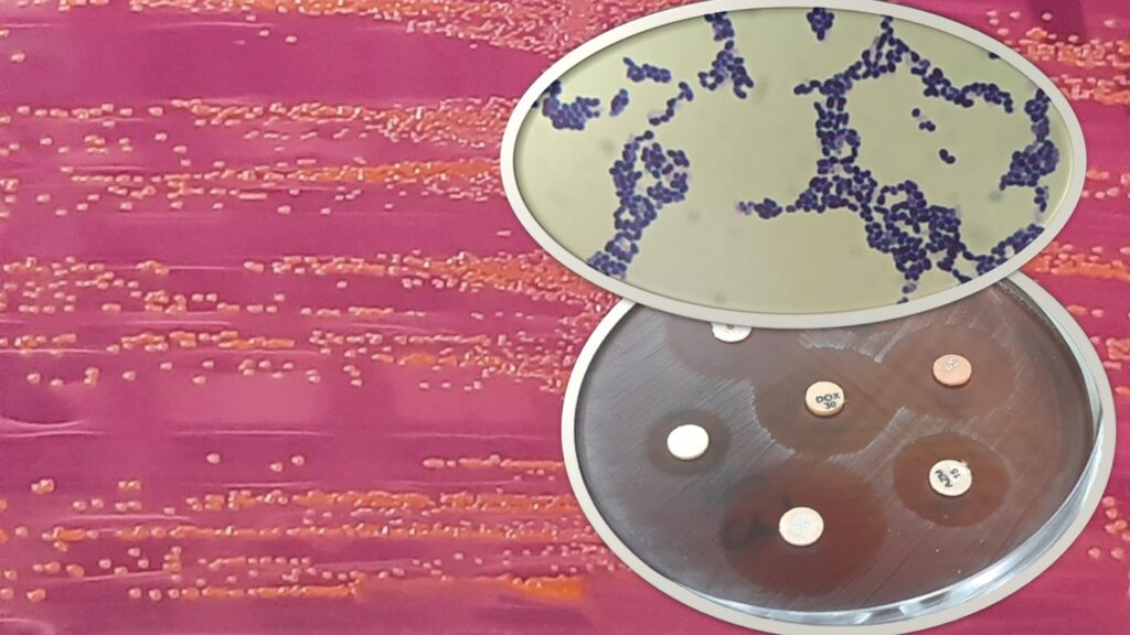 Lactococcus garvieae: Introduction, Pathogenicity, Lab Diagnosis, Treatment, Prevention, and Keynotes