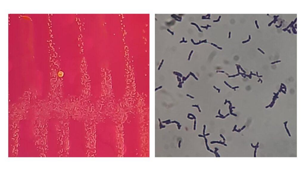 Rothia kristinae: Introduction, Pathogenicity, Lab Diagnosis, Treatment, Prevention, and Keynotes