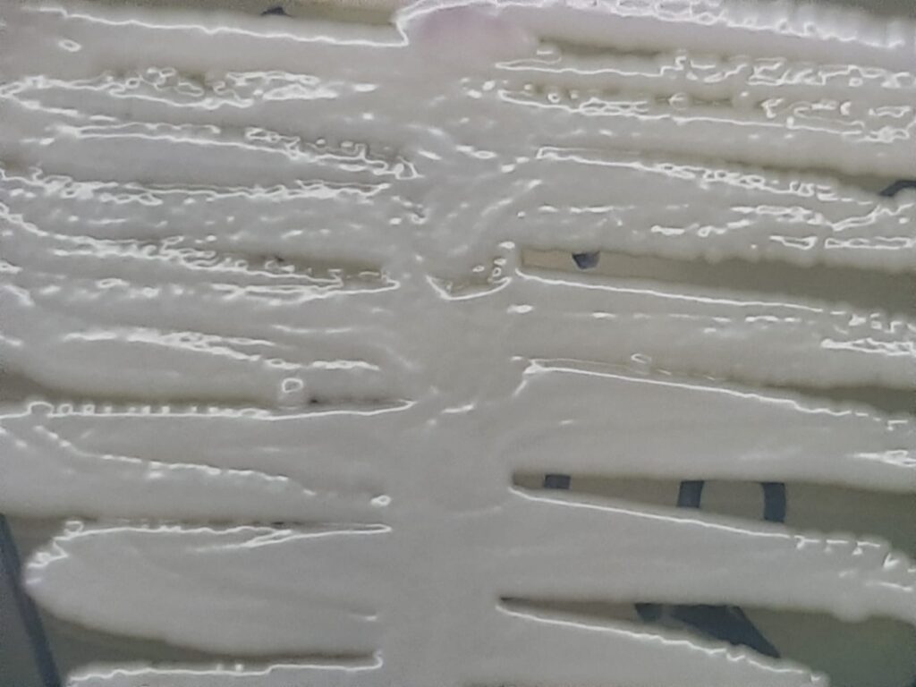 Nakaseomyces glabratus-Introduction, Morphology, Pathogenicity, Lab Diagnosis, Treatment, Prevention, and Keynotes