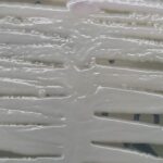 Nakaseomyces glabratus-Introduction, Morphology, Pathogenicity, Lab Diagnosis, Treatment, Prevention, and Keynotes