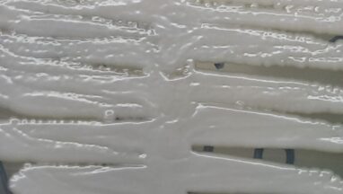 Nakaseomyces glabratus-Introduction, Morphology, Pathogenicity, Lab Diagnosis, Treatment, Prevention, and Keynotes