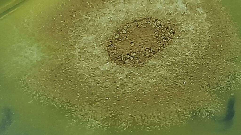 Aspergillus terreus: Introduction, Morphology, Pathogenicity, Lab Diagnosis, Treatment, Prevention, and Keynotes