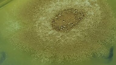 Aspergillus terreus: Introduction, Morphology, Pathogenicity, Lab Diagnosis, Treatment, Prevention, and Keynotes