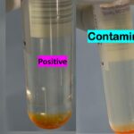 MGIT Culture Outcomes-Introduction, Identification, Causes of Contamination, and Keynotes