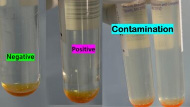 MGIT Culture Outcomes-Introduction, Identification, Causes of Contamination, and Keynotes