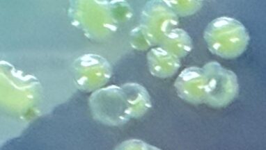 Acinetobacter baumannii complex colony morphology on CLED agar