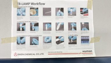 TB-LAMP- Introduction, Principle, Procedure, Result Interpretation, and Keynotes